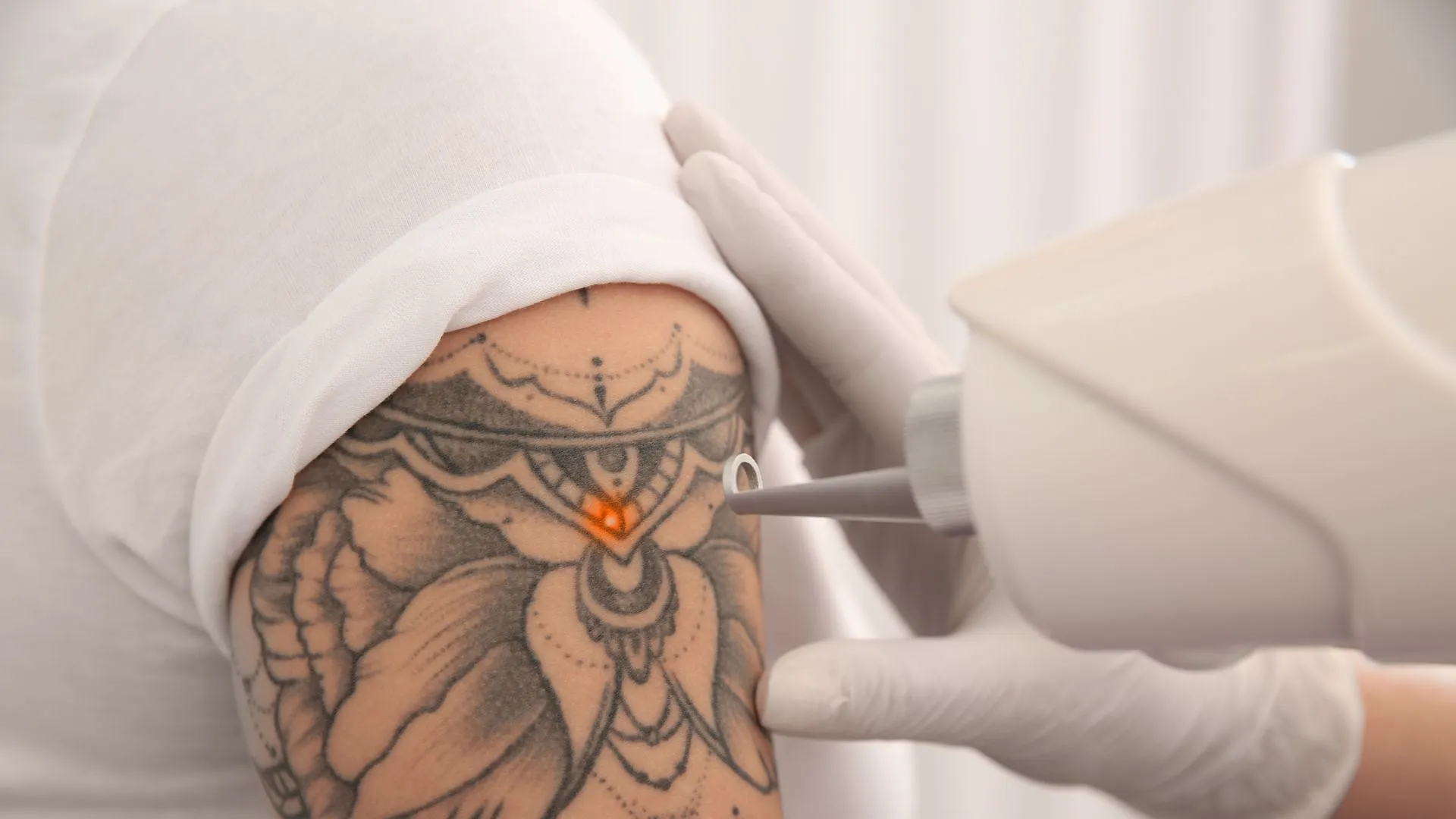 Tatouages : de symbole rebelle à effet de mode, et si l’heure était au détatouage ? - Anissa Hezzaz