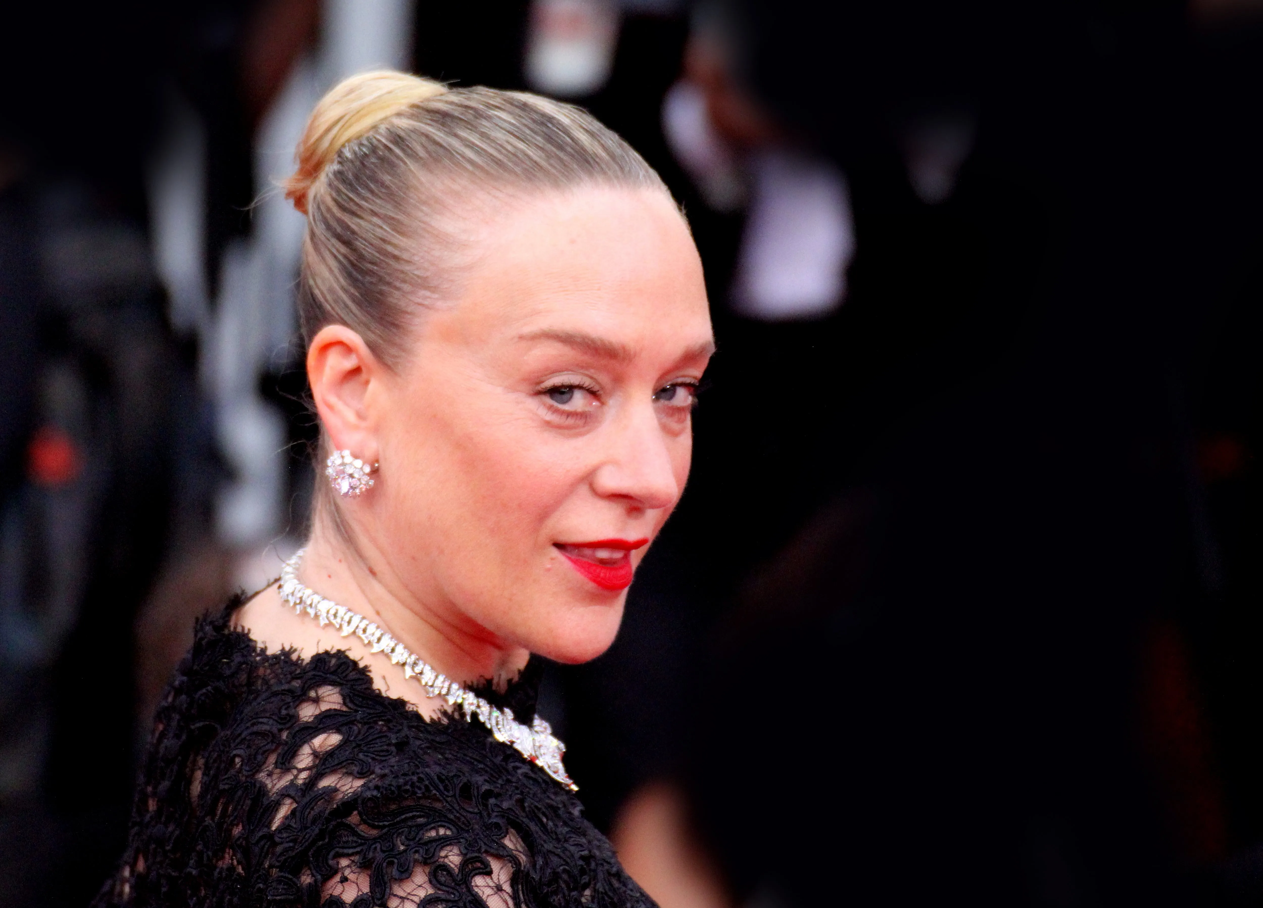 Le lip flip : la technique esthtique critique par des stars, mais  ultra-tendance sur les rseaux - SoSoir
