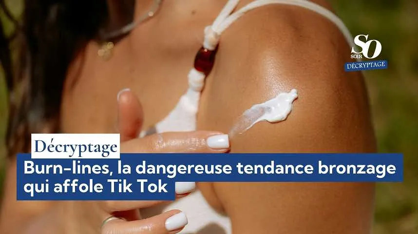 Décryptage : burn-lines, la dangereuse tendance bronzage qui affole Tik Tok - Décryptage : burn-lines, la dangereuse tendance bronzage qui affole Tik Tok