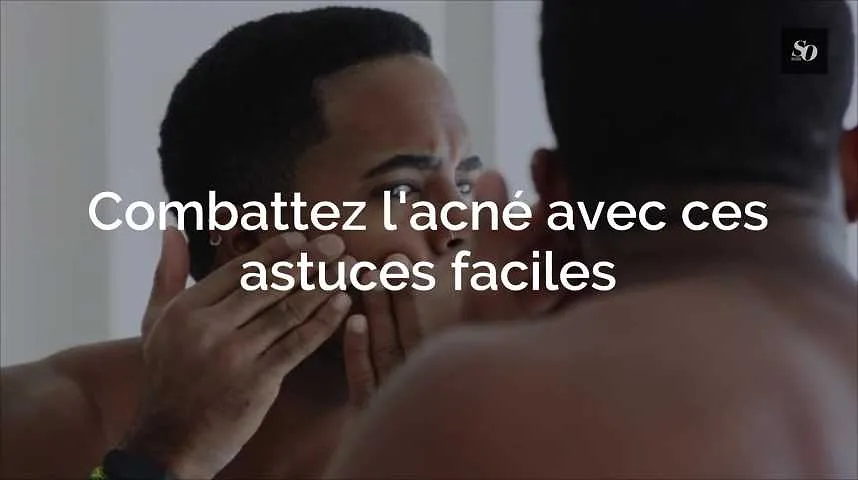 Combattez l'acné avec ces astuces faciles