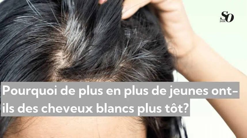 Pourquoi de plus en plus de jeunes ont-ils des cheveux blancs plus tôt? - Pourquoi de plus en plus de jeunes ont-ils des cheveux blancs plus tôt?